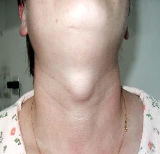 Head and neck surgeries